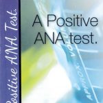 A Positive ANA
