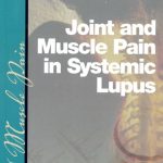 Joint & Muscle Pain in SLE