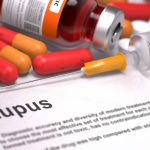 lupus treatments